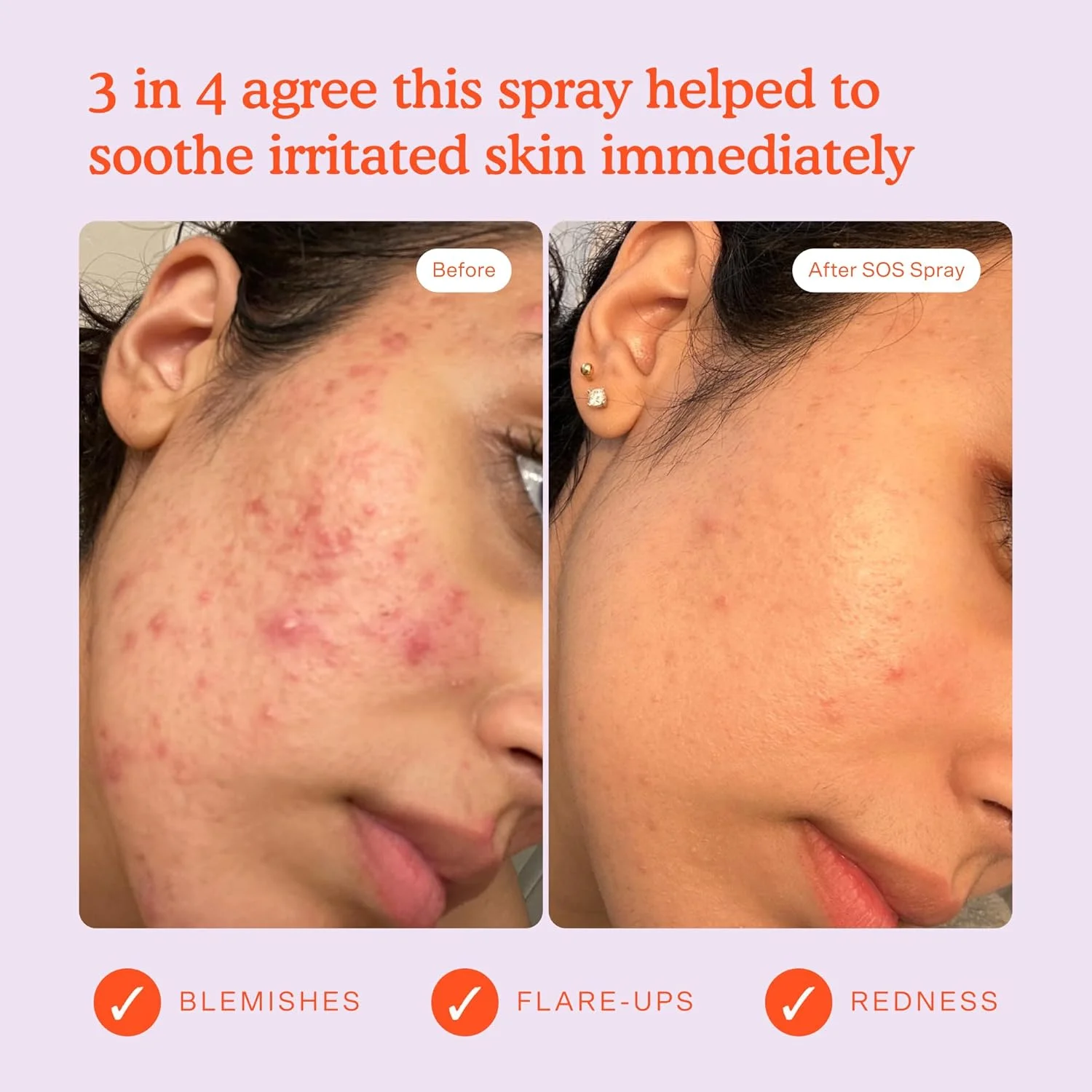 اسپری صورت نجات روزانه مینی SOS Tower 28 Beauty