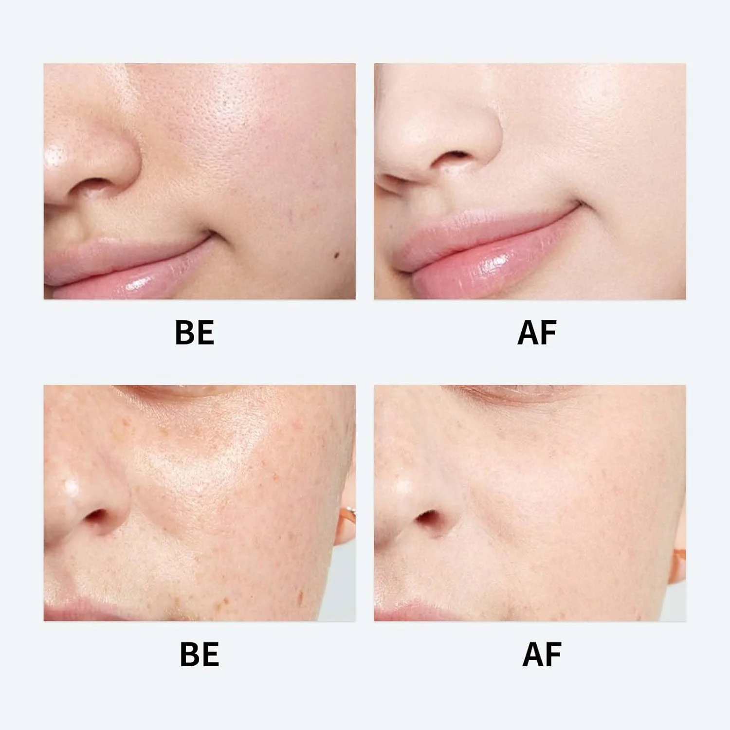 کرم مرطوب کننده نیدا فرمول جوانی، کرم کره ای، کرم مرطوب کننده فرمول جوانی، مناسب برای انواع پوست 100 میلی لیتر/1 عدد کرم مرطوب کننده نیدا فرمول جوانی، کرم کره ای، کرم مرطوب کننده فرمول جوانی، مناسب برای انواع پوست 100 میلی لیتر/1 عدد