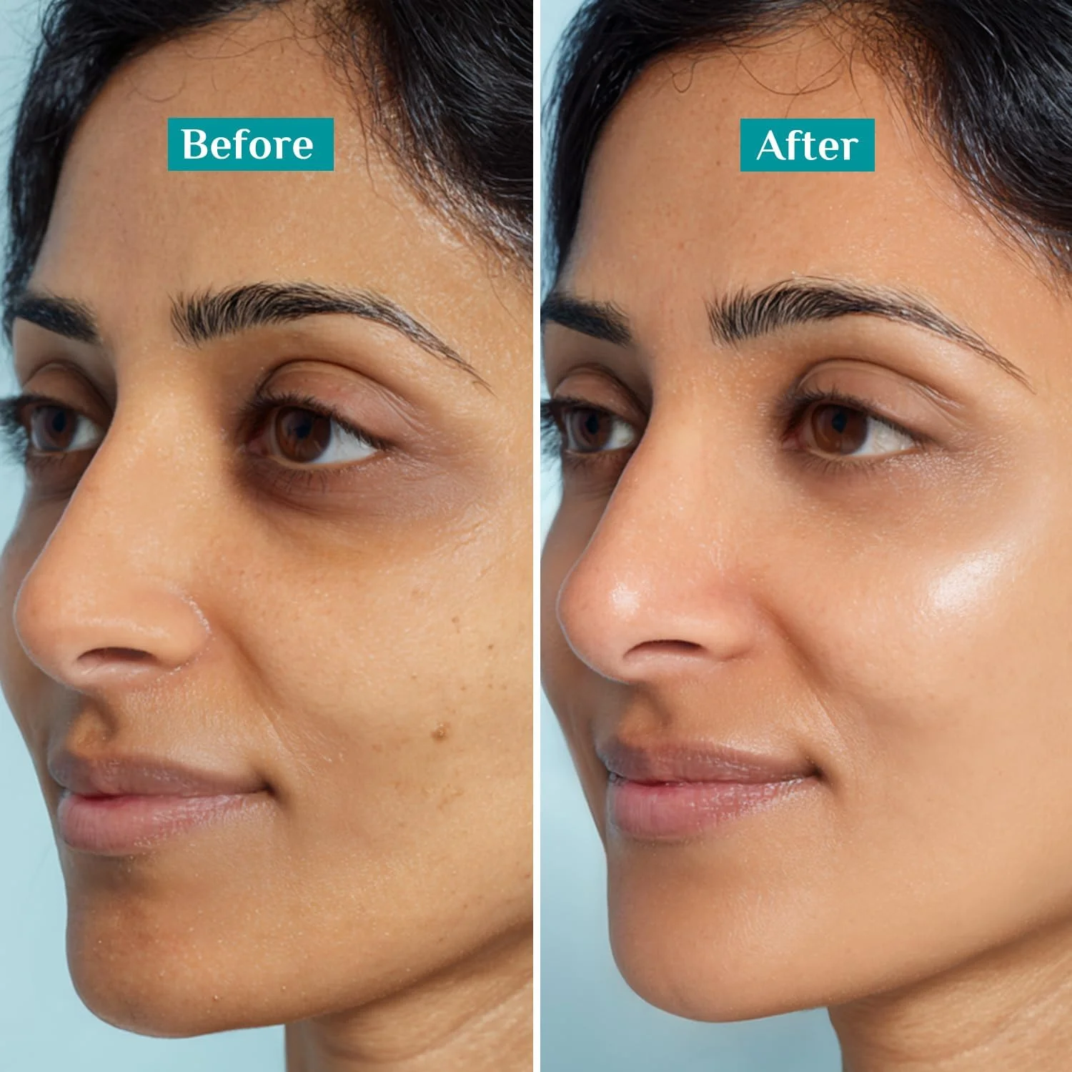 مرطوب کننده صورت پیلگریم اسکوالان نیاسینامید و ویتامین سی برای درخشش پوست | مرطوب کننده برای آبرسانی پوست خشک | مرطوب کننده صورت با ویتامین سی برای پوست درخشان | غیر چرب | 50 گرم