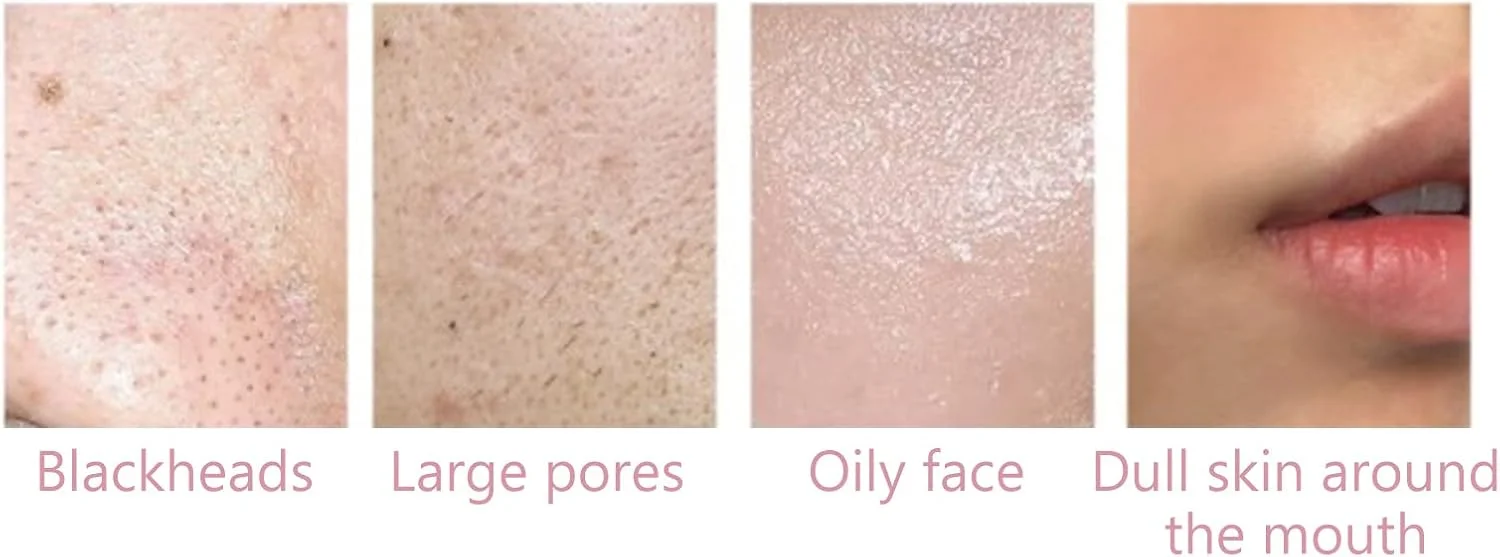 کرم لایه بردار مرطوب کننده صورت، پاک کننده عمیق با رایحه هلو، مناسب برای استفاده روزانه بانوان