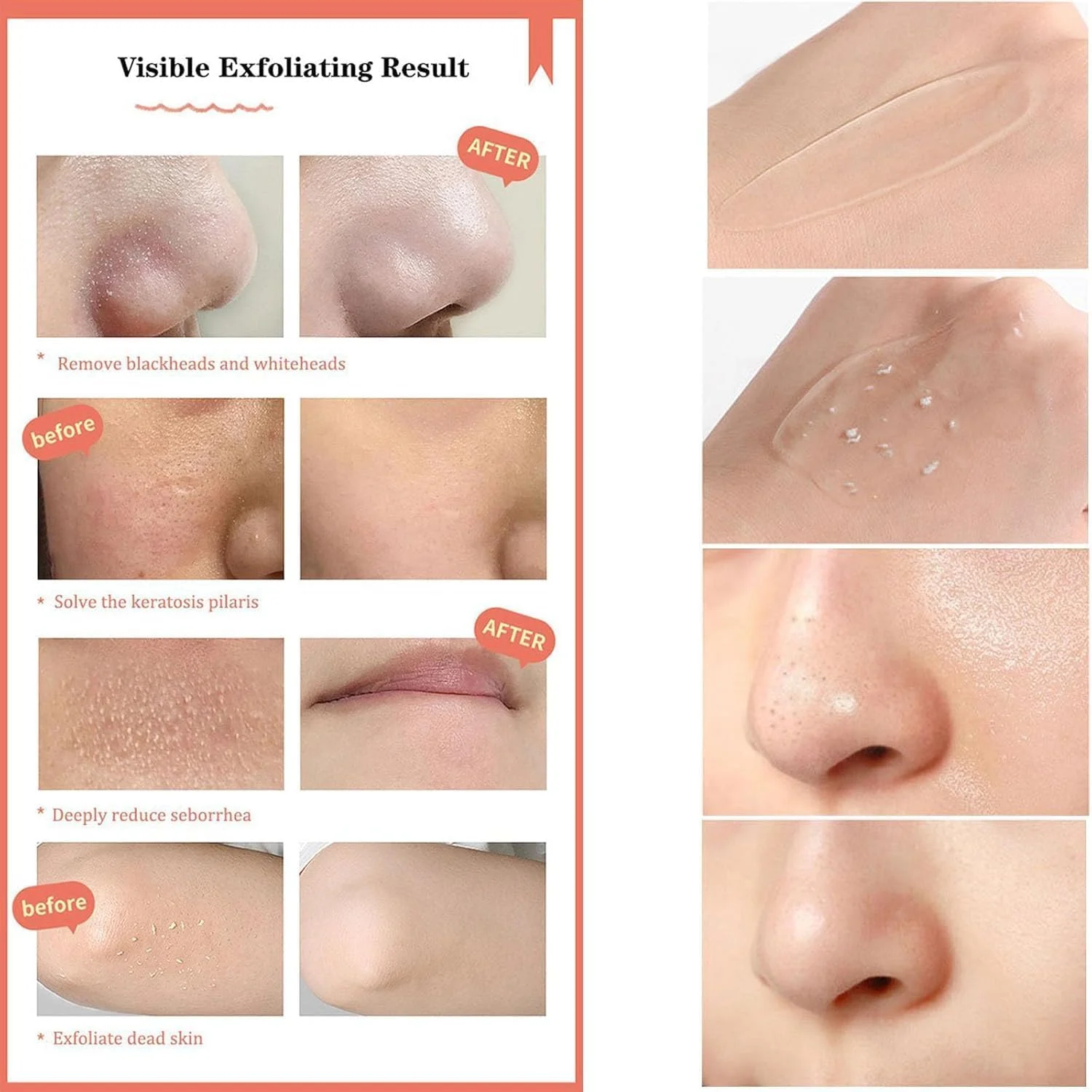 ژل پاک کننده لایه بردار آلوئه ورا NALACAL - اسکراب و ژل لایه بردار ارگانیک صورت - لایه برداری ملایم برای کل بدن - ایده آل برای پاها، دست ها، آرنج ها و زانوها - 100 گرم / 3.53 fl. oz (2 عدد)