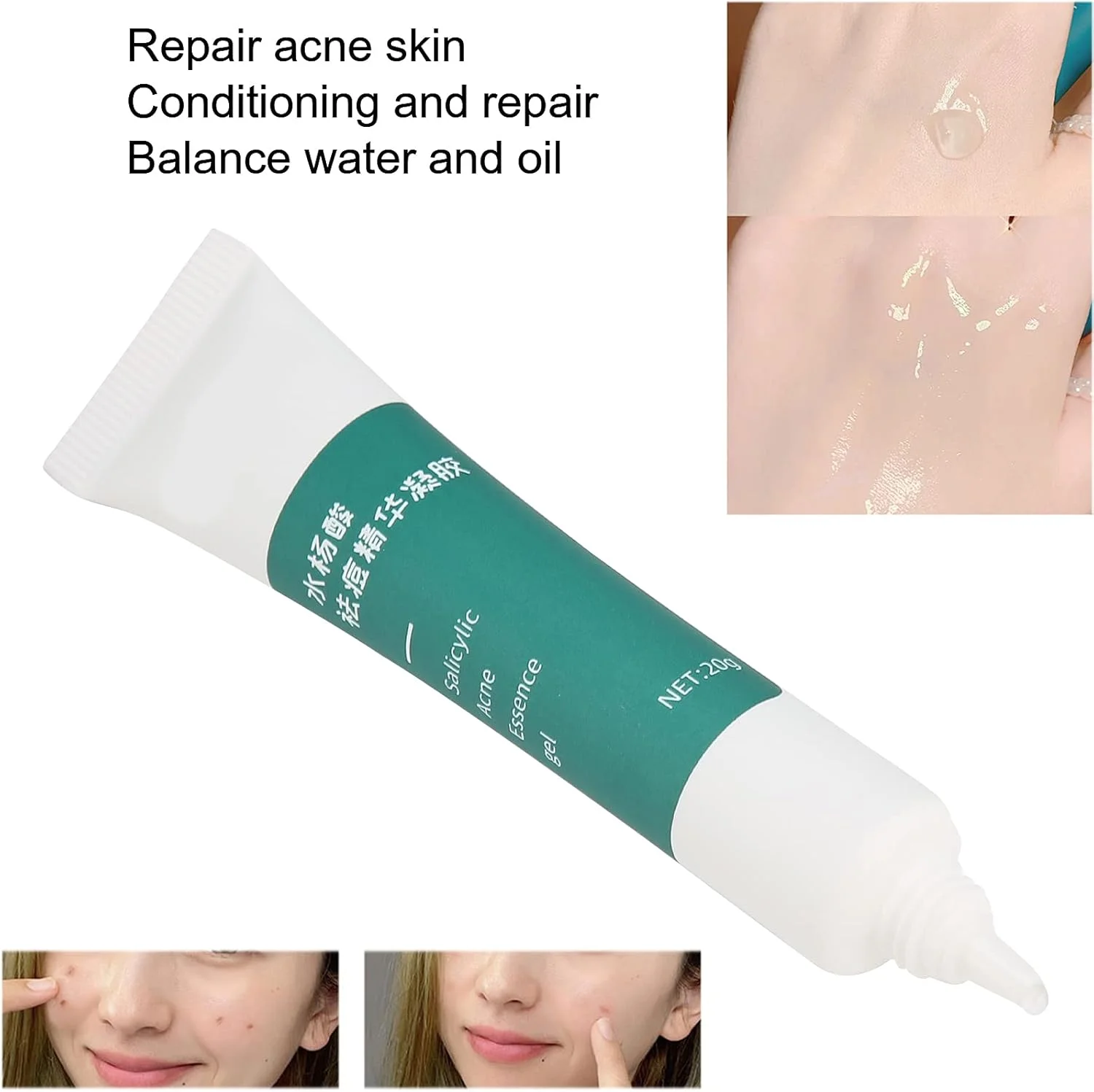 ژل ملایم رفع آکنه، سرم صورت، سرم اسید هیالورونیک برای صورت کاهش چین و چروک، روشن کننده و حفظ جوانی، ضروری قابل حمل و انفرادی برای انواع پوست