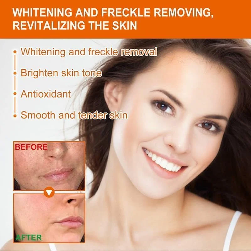 مجموعه ۳ عددی اسانس روشن کننده و رفع لک، سرم ضد لک، سرم ویتامین C اصلاح کننده لک تیره صورت، کرم جادویی روشن کننده لک