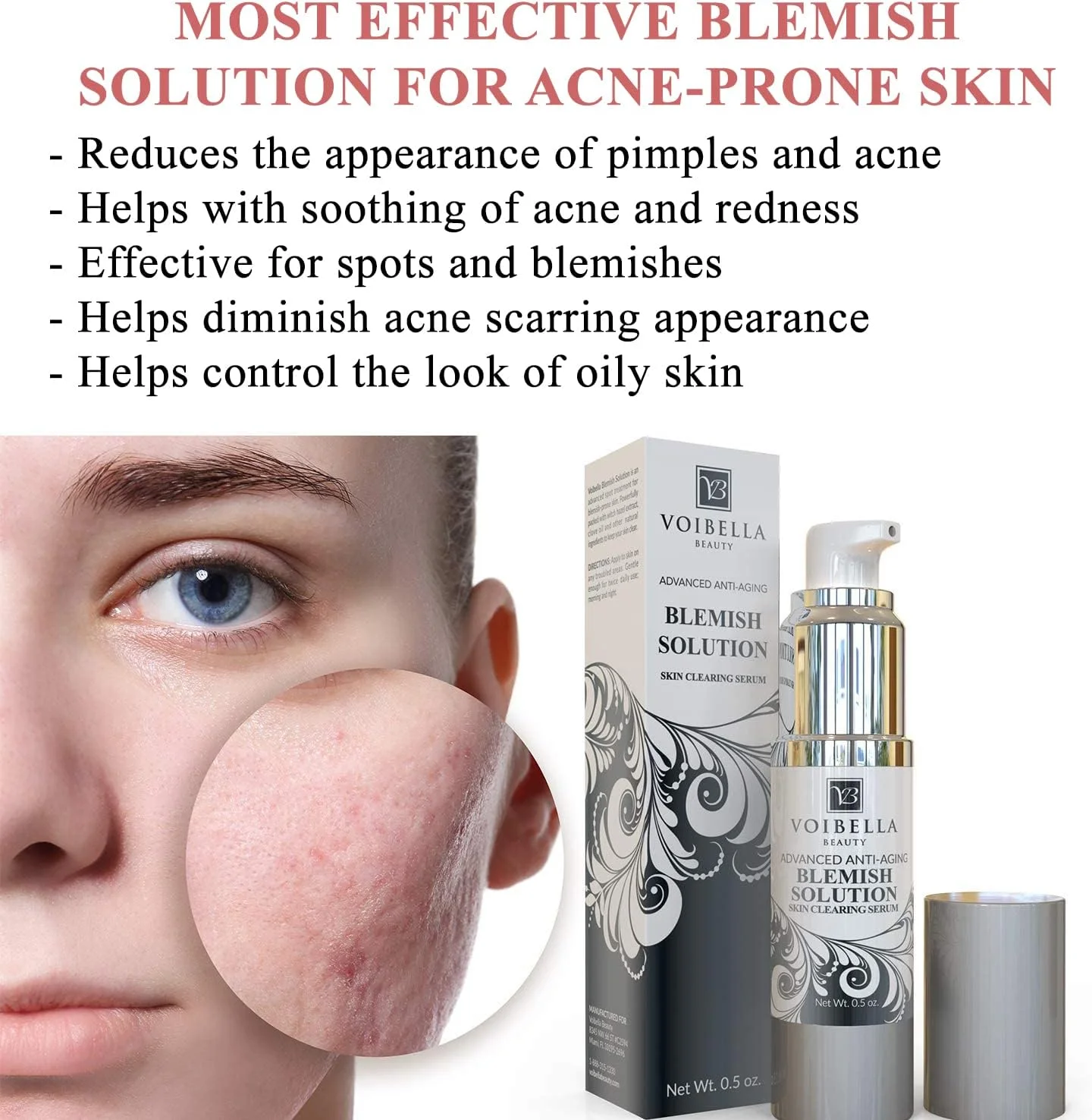 کرم درمان لک، از بین برنده و ضد ظاهر آکنه - سرم قرمزی، لکه های تیره و جوش برای کاهش ظاهر آکنه کیستی، جوش ها و جای زخم روی صورت، پشت، بدن (مردان، زنان، نوجوانان) کرم درمان لک، از بین برنده و ضد ظاهر آکنه - سرم قرمزی، لکه های تیره و جوش برای کاهش ظاهر آکنه کیستی، جوش ها و جای زخم روی صورت، پشت، بدن (مردان، زنان، نوجوانان)