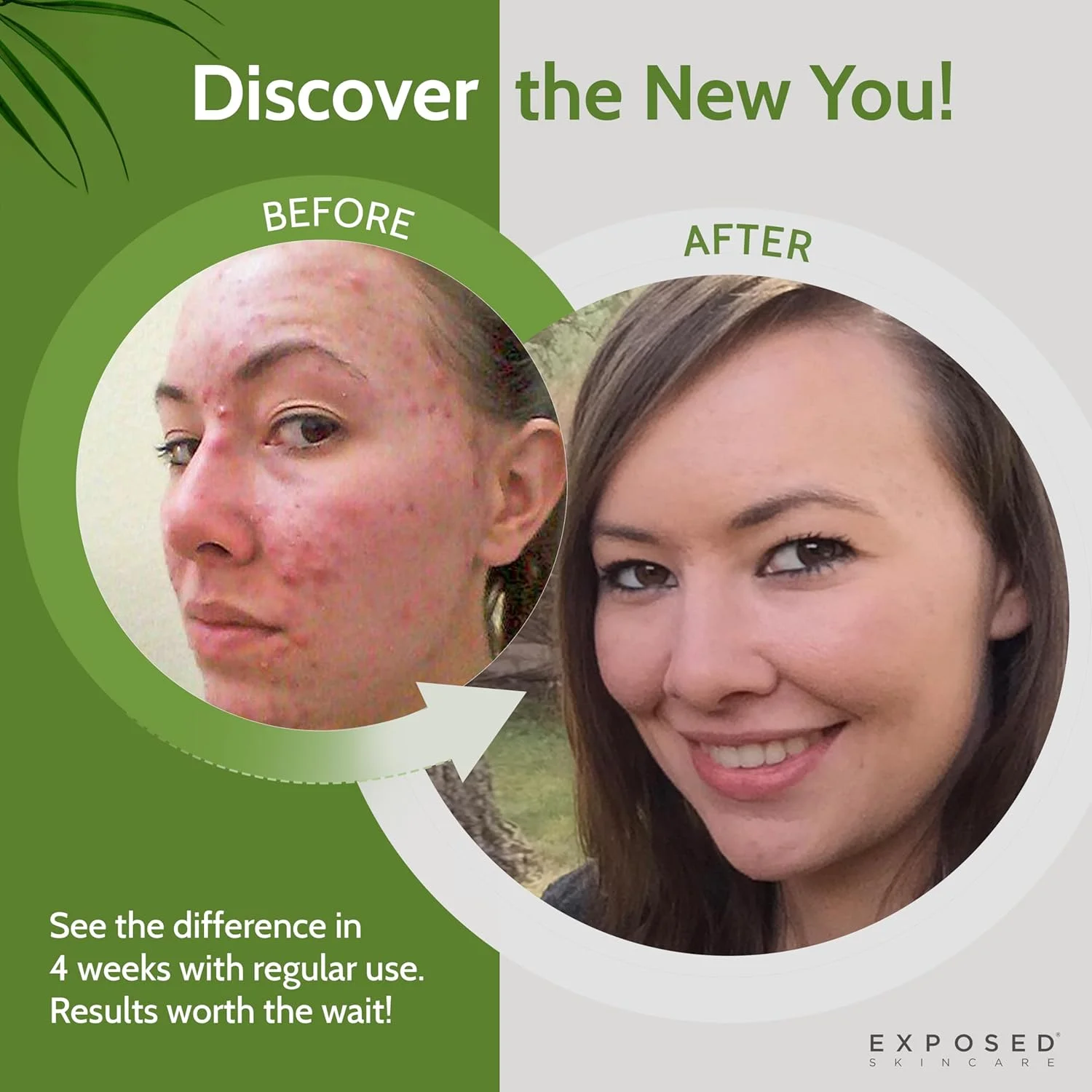 مجموعه مراقبت از پوست در معرض آکنه - شامل پاک کننده صورت، تونیک پاک کننده، سرم درمان آکنه، سرم پاک کننده منافذ، ماسک شفاف کننده، پارچه - محلول طبیعی آکنه برای صورت، تمام سنین و انواع پوست