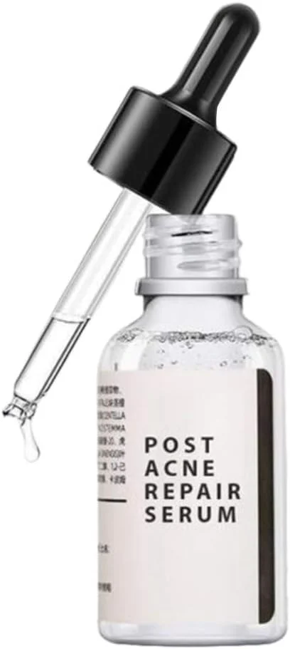 اسانس درمان پوست، درمان جای پوست 30 میلی لیتر، اسانس صورت، محو کننده جای پوست و سرم صورت برای لک و مراقبت از پوست