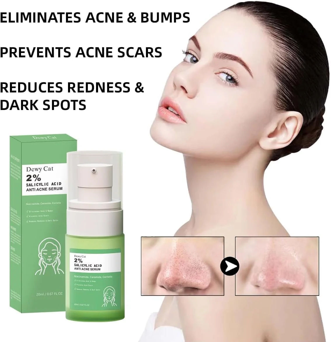 لایه بردار حاوی 2% سالیسیلیک اسید، محلول سالیسیلیک اسید، سرم ملایم صورت برای پوستی صاف و شفاف تر، سرم ضد جوش، مناسب برای انواع پوست