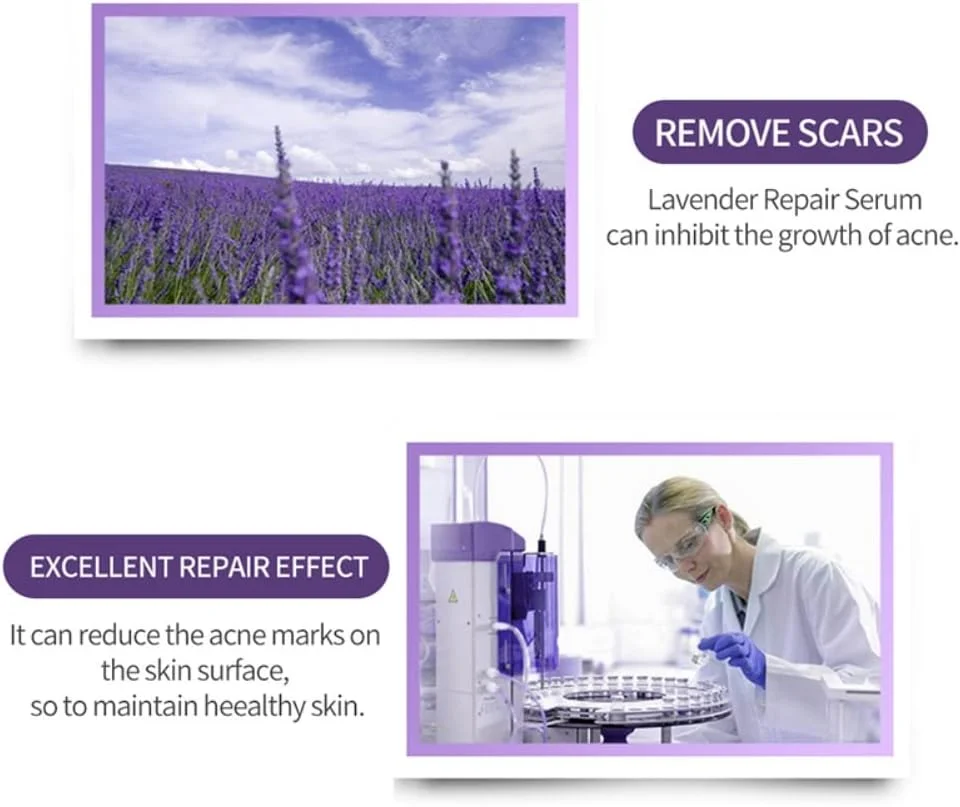 روغن اسطوخودوس طبیعی ترمیم کننده جای زخم با سرم اسید هیالورونیک ضد آکنه صورت