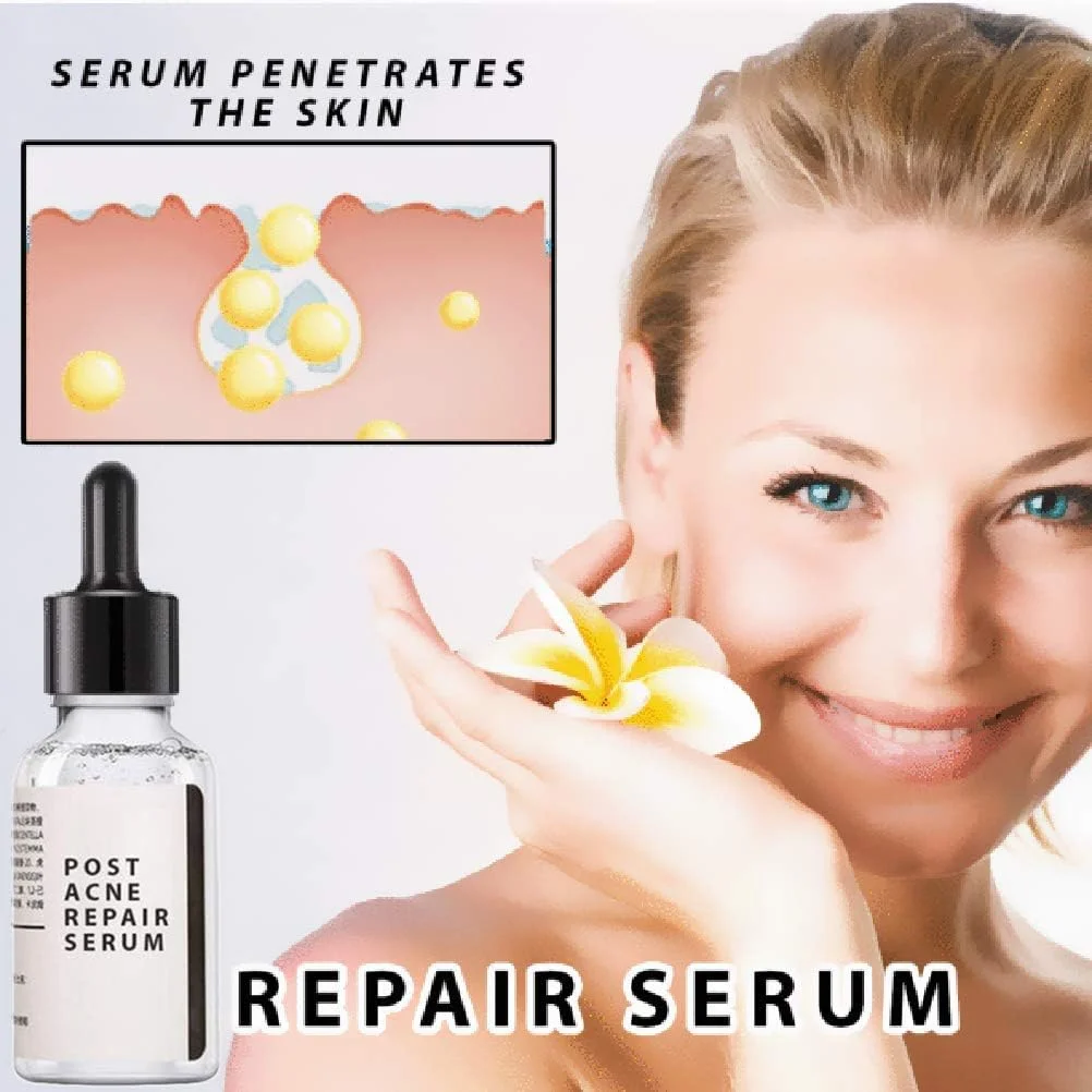 اسانس درمان پوست، درمان جای پوست 30 میلی لیتر، اسانس صورت، محو کننده جای پوست و سرم صورت برای لک و مراقبت از پوست اسانس درمان پوست، درمان جای پوست 30 میلی لیتر، اسانس صورت، محو کننده جای پوست و سرم صورت برای لک و مراقبت از پوست