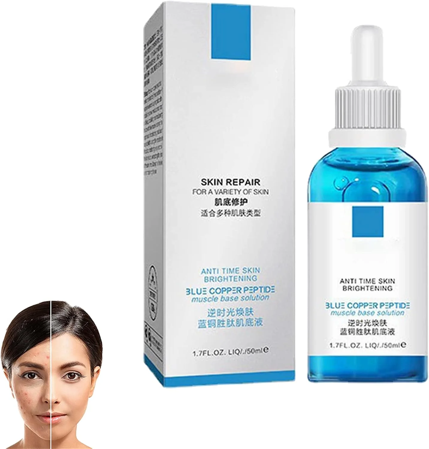 سرم ضد لک و جوش Bio Re Youth، سرم درمان لک تیره و جوش Bio ReYouth، سرم رفع لک و جوش Bio Re Youth، آبرسان و مرطوب کننده صورت (1 عدد)