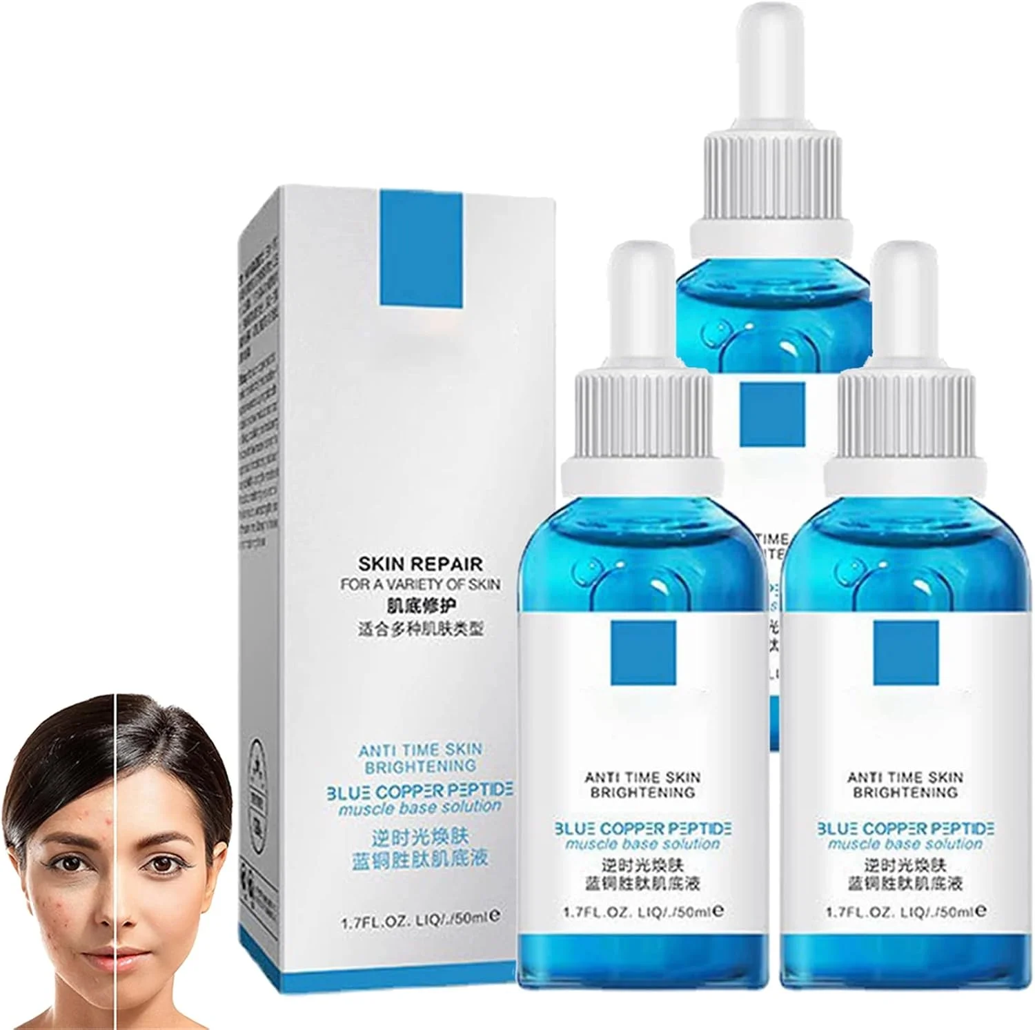 سرم ضد لک و جوش Bio Re Youth، سرم درمان لک تیره و جوش Bio ReYouth، سرم رفع لک و جوش Bio Re Youth، آبرسان و مرطوب کننده صورت (3 عدد)