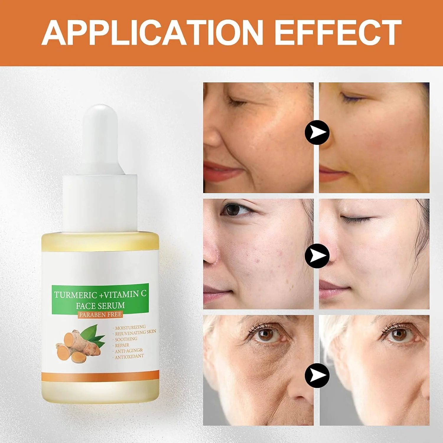 سرم اصلاح کننده لکه‌های تیره زردچوبه و سرم ویتامین C برای صورت، از بین برنده درخشش و اصلاح کننده لکه‌های تیره صورت، زردچوبه برای آکنه، هایپرپیگمنتیشن و پوست صاف 30 میل