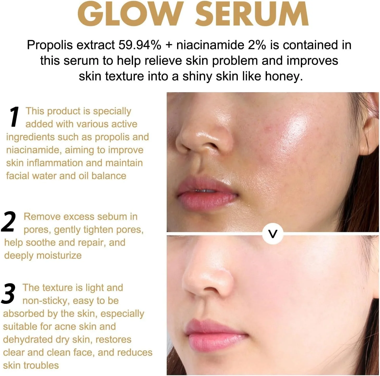 سرم صورت درخشان کننده با پروپولیس و نیاسینامید، فرمول مراقبت از پوست کره ای، پوست کدر را هدف قرار داده و رنگ چهره را روشن می کند، مناسب برای انواع پوست، درمان ملایم و مغذی صورت