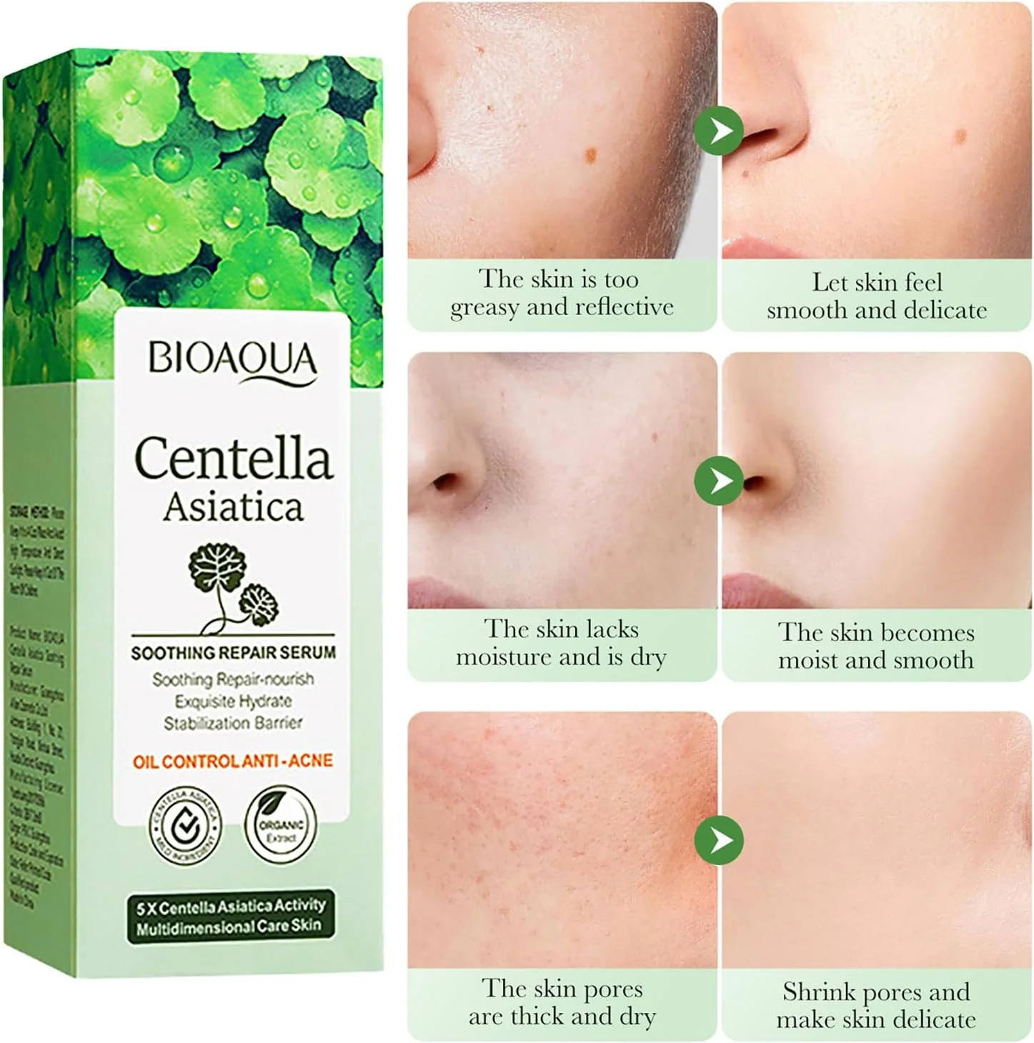 سرم صورت تسکین دهنده و ترمیم کننده سنتلا آسیاتیکا بایوآکوا، کنترل کننده چربی، ضد جوش، مراقبت از پوست صورت 30 میلی لیتر