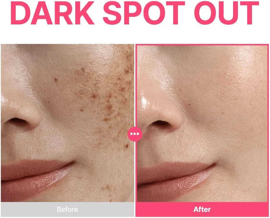 سرم صورت پیوریتو حاوی ترانگزامیک اسید 6%، نیاسینامید 10% و رتینال، برای لکه‌های تیره، جای جوش، رنگ ناهموار پوست و هایپرپیگمنتیشن، فرمول فعال سه گانه 16% برای پوست شفاف، مراقبت از پوست کره‌ای، 30 میلی لیتر