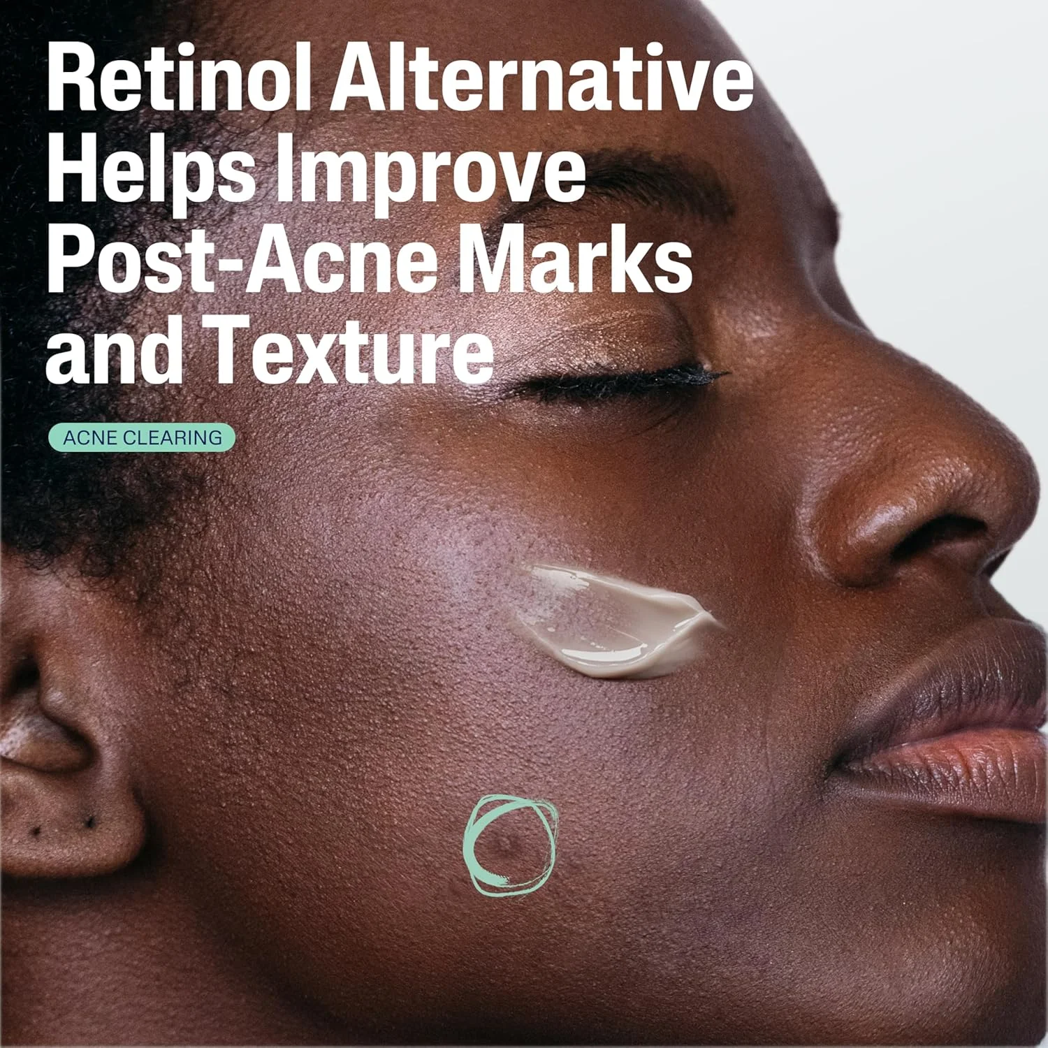 سرم ترمیم کننده ملایم پوست پس از جوش ستافیل، جایگزین رتینول، سرم فاقد چربی برای پوست حساس، 30 میلی لیتر، باکوچیول، بهبود رنگ پوست و علائم پس از جوش، توصیه شده توسط متخصصین پوست