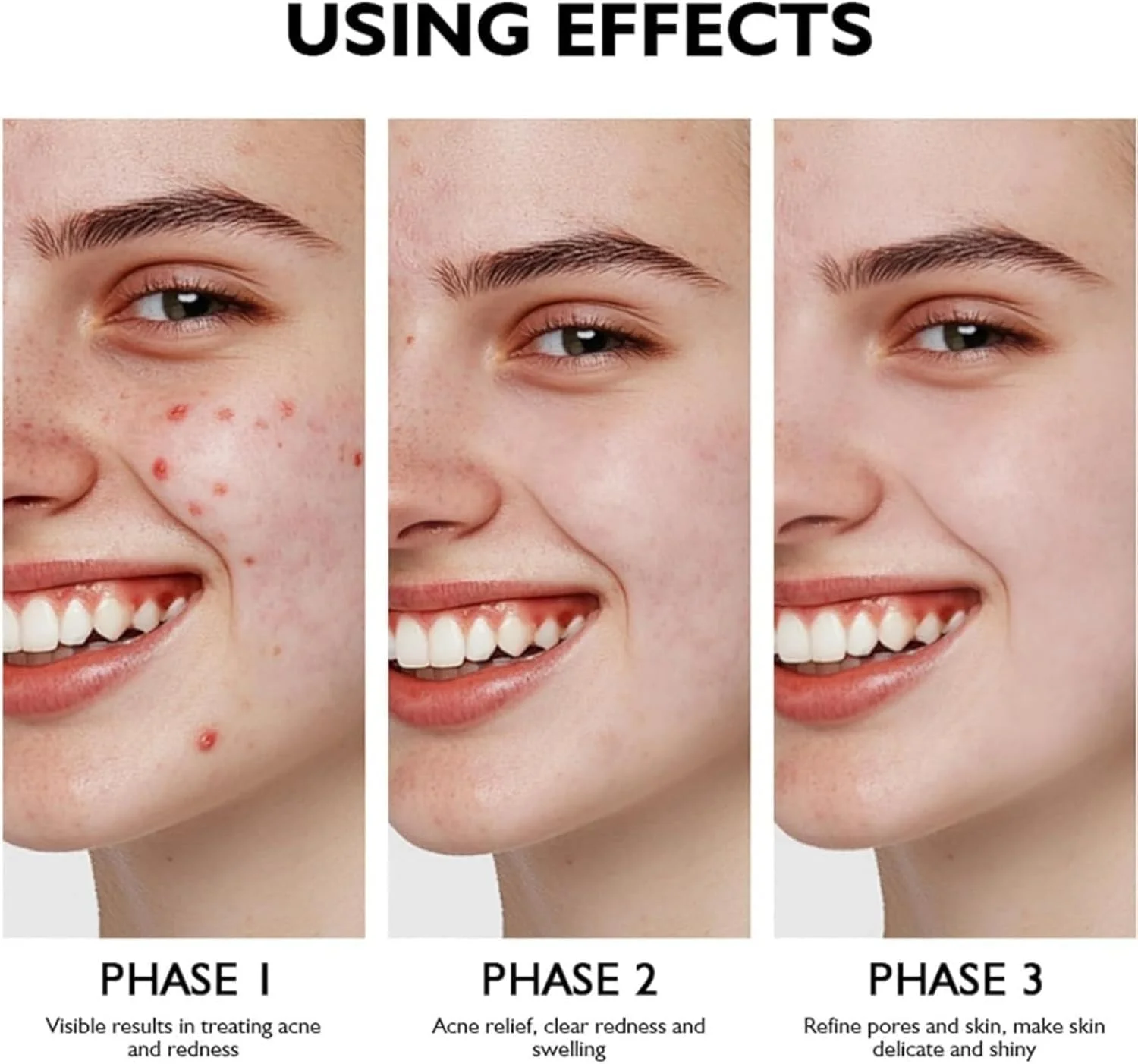 ژل درمان آکنه حاوی 15% اسید آزلائیک، ژل درمان آکنه صورت حاوی 15% اسید، کرم اسید آزلائیک برای صورت، سرم صورت اسیدی، کرم سرم اسید آزلائیک با نیاسینامید و ویتامین C، ژل ضد آکنه برای لک