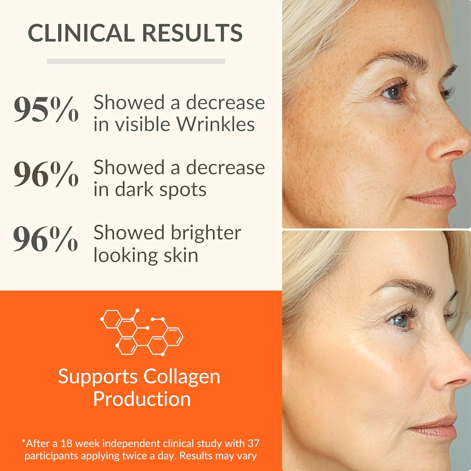 سرم ویتامین C Levaye – سرم صورت ضد پیری حاوی ویتامین C، اسید فرولیک، اسید هیالورونیک و ویتامین E – سرم روشن کننده. مناسب برای لک های تیره، خطوط ریز، چروک ها، خشکی پوست و استحکام پوست، 50 میلی لیتر