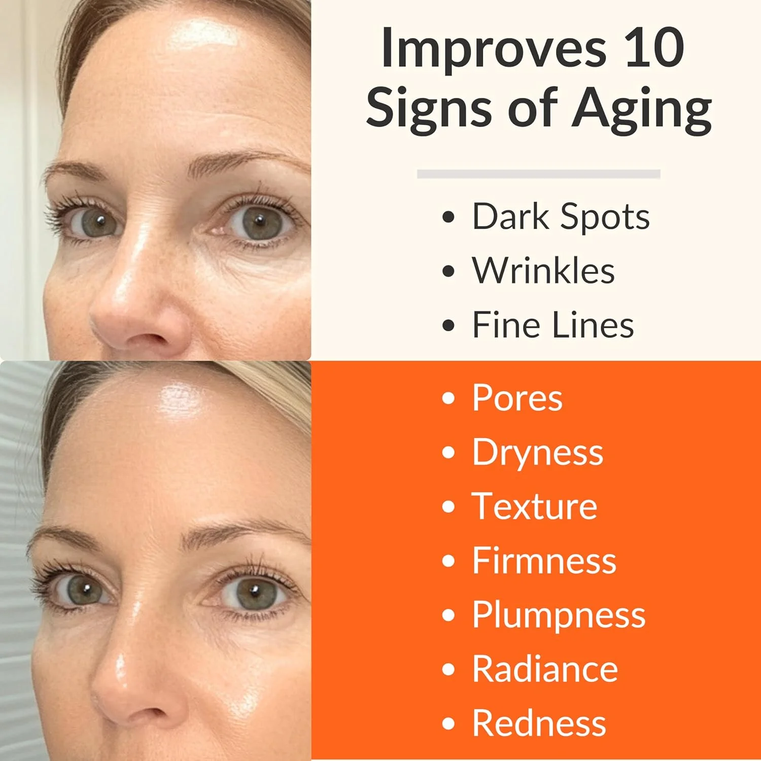 سرم ویتامین C Levaye – سرم صورت ضد پیری حاوی ویتامین C، اسید فرولیک، اسید هیالورونیک و ویتامین E – سرم روشن کننده. مناسب برای لک های تیره، خطوط ریز، چروک ها، خشکی پوست و استحکام پوست، 50 میلی لیتر