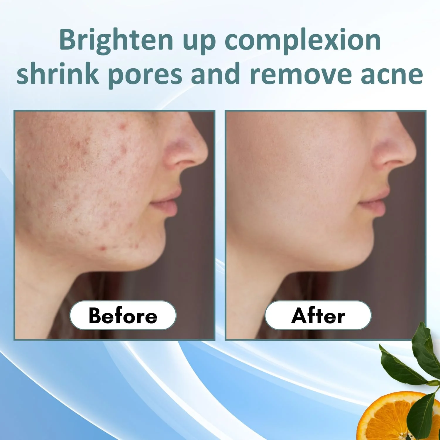 سرم صورت ویتامین C 10% برای پوست درخشان، سرم روشن کننده پوست، سرم صورت برای زنان و مردان، ضد پیری، کاهش لکه های تیره 30 میلی لیتر (بسته 1 عددی)