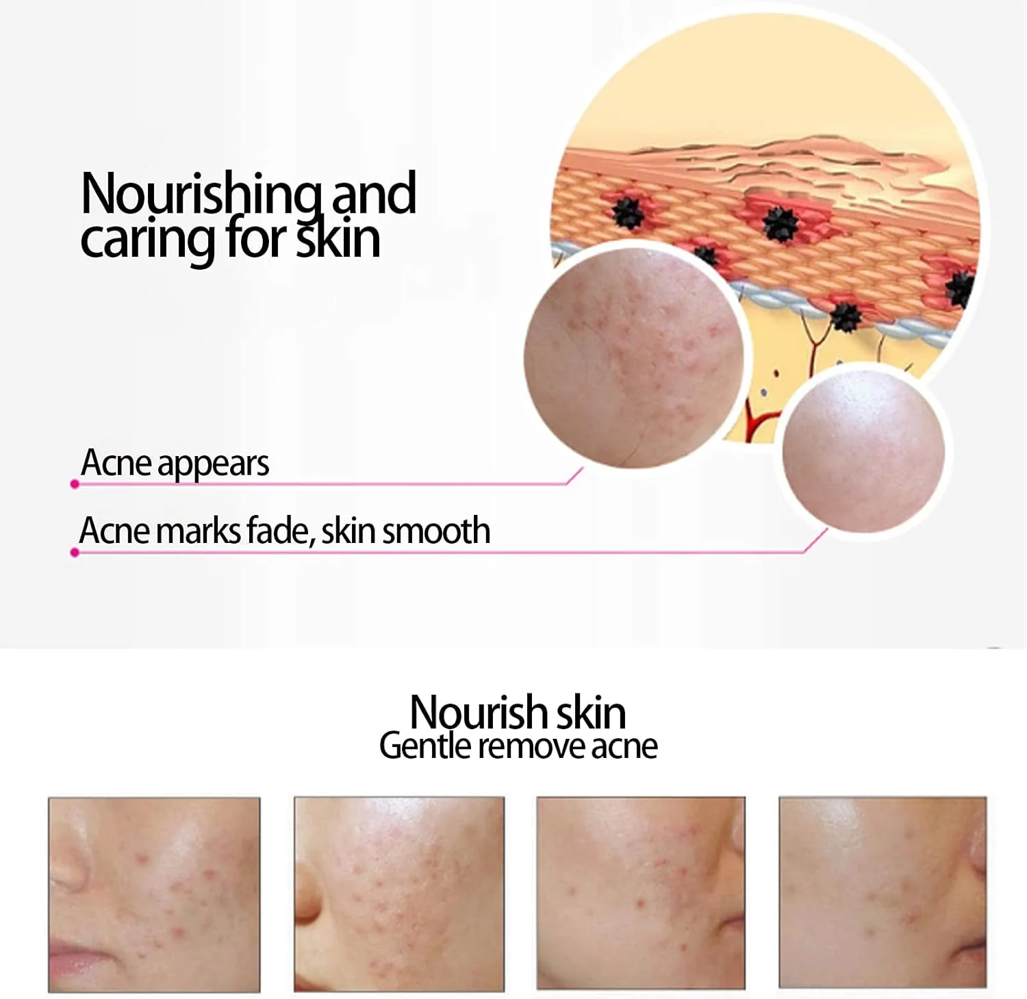 سرم صورت ضد جوش کنترل کننده چربی مرطوب کننده روشن کننده پوست 30 میلی لیتر، کرم صورت ترمیم کننده و سفت کننده پوست