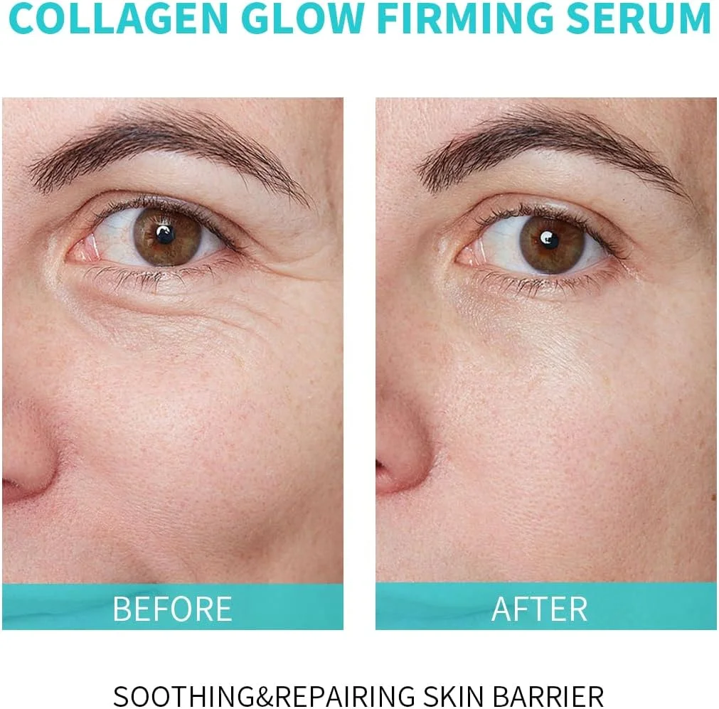 سرم آمپول نرم کننده و سفت کننده صورت کلاژن گلو با کلاژن محلول، برای کاهش خطوط خشک و ریز، سرم روشن کننده و آبرسان صورت با عصاره سنتلا آسیاتیکا، 30 عدد در جعبه