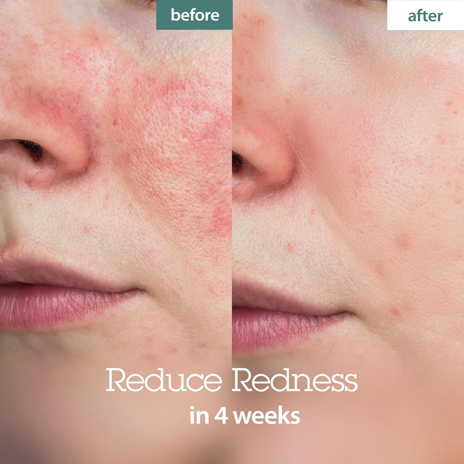 سرم فشرده بلیت با عصاره گیاه یخی، 50 میلی لیتر - مراقبت از پوست کره ای، ضد چروک، تسکین دهنده و آبرسان، عصاره گیاه یخی، زیبایی کره ای، مراقبت از صورت روشن کننده پوست با مواد طبیعی، مناسب برای انواع پوست