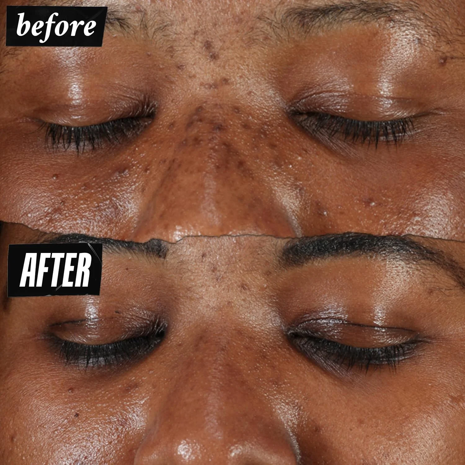 سرم روشن کننده و اصلاح کننده رنگ پوست کیلز، کاهش دهنده تیرگی ها، لک های ناشی از هایپرپیگمنتیشن و جای جوش، حاوی ویتامین C و سالیسیلیک اسید، مناسب انواع پوست، فاقد پارابن - 15 میلی لیتر