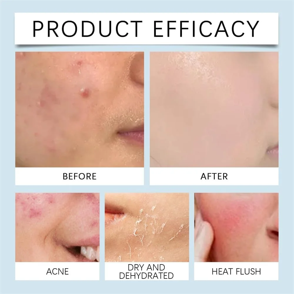 سرم هیالورونیک اسید میکرونیدلینگ، سیستم میکرو-تزریق برای آبرسانی و درمان ضد چروک صورت، صاف کننده پوست و بهبود بافت