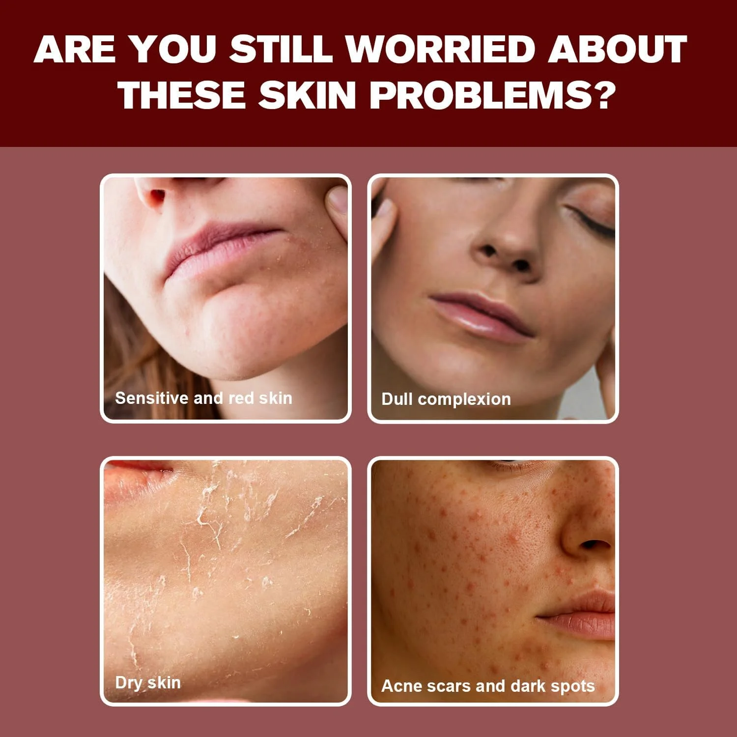 سرم آبرسان صورت حاوی 10% نیاسینامید + 4% سرم روشن کننده TXA - فرمول بدون عطر با ویتامین B12، اسید هیالورونیک و عصاره های گیاهی، 30 میلی لیتر