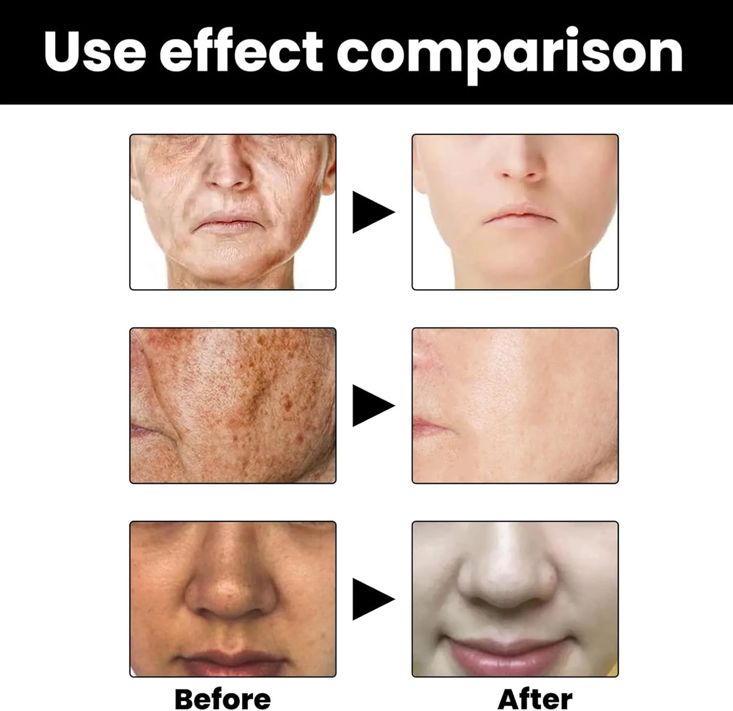 سرم صورت اصلاح کننده لکه‌های تیره، 2 عدد، سرم صورت روشن کننده، سرم‌های اصلاح کننده سریع لکه‌های تیره، بهبود پوست خشک و صاف، سرم‌های روشن کننده، از بین برنده لکه‌های تیره برای اصلاح ملانین