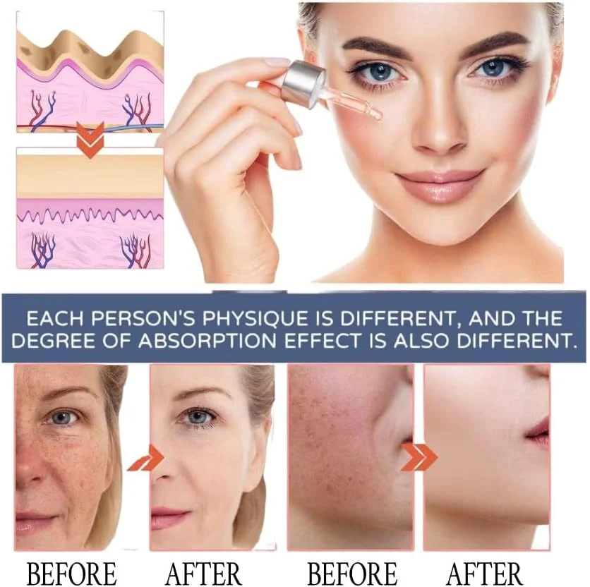 سرم صورت 5 در 1 پریمبلی حاوی هیالورونیک اسید، کلاژن، نیاسینامید و ویتامین C | (30 میلی لیتر) - کوچک کننده منافذ، روشن کننده و سرم فوق آبرسان برای زنان و مردان | مرطوب کننده روزانه، ضد پیری، غیر تحریک کننده برای انواع پوست