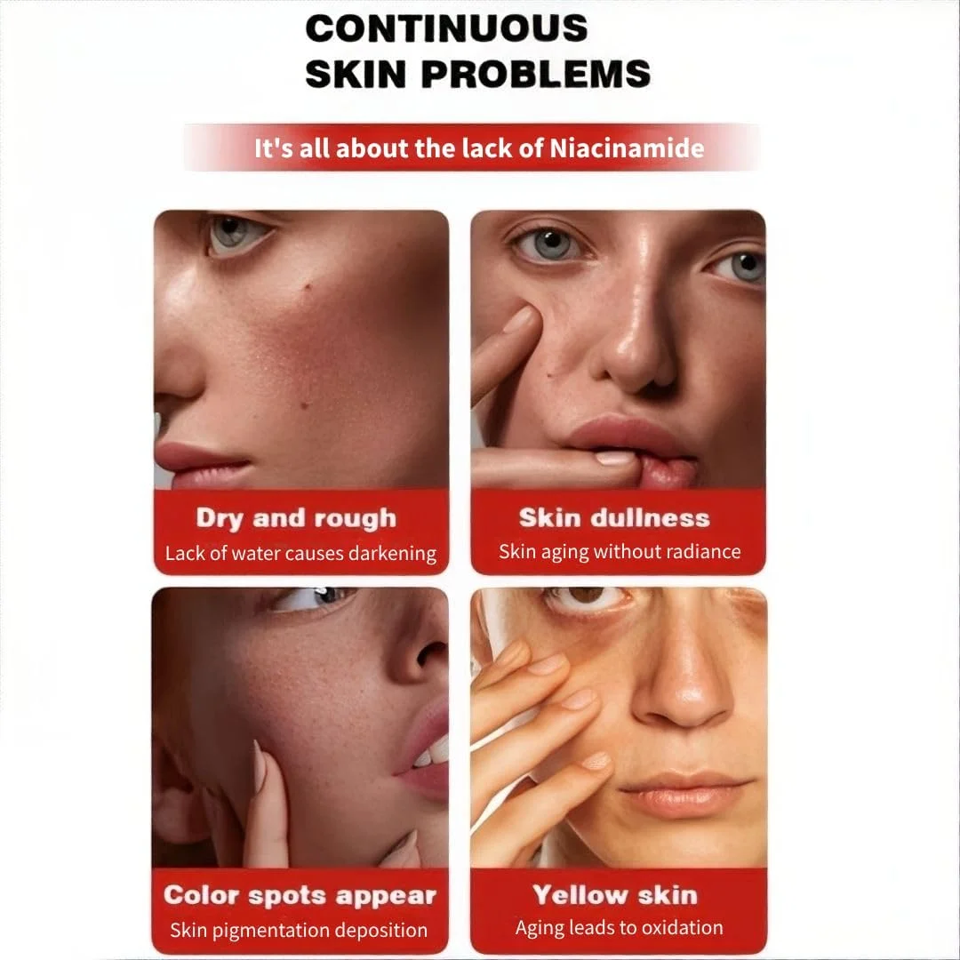 سرم پیشرفته روشن کننده پوست با نیاسینامید 10٪ + ترانگزامیک اسید 4٪، هیالورونیک اسید و ویتامین B12 | سرم صورت برای پوستی شفاف و درخشان با پوستی طبیعی