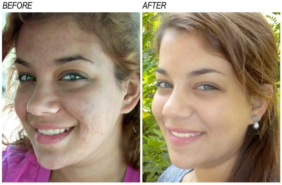 سرم روشن کننده ویتامین C نئوپروزون | 30 میلی لیتر | سرم اصلاح کننده لک تیره صورت | سرم صورت ضد چروک | سرم آبرسان و مرطوب کننده صورت با آلفا آربوتین و روغن کرچک