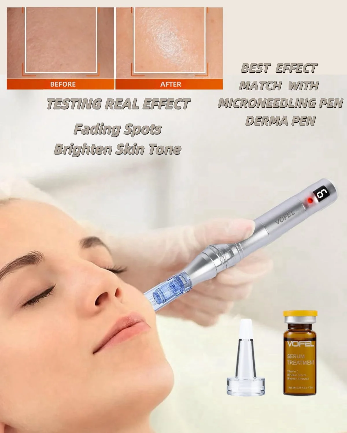 سرم ویتامین C برای صورت، سرم هیالورونیک اسید، مرطوب کننده ضد پیری، 10 میلی لیتر، 4 ویال، کیت شروع سرم های صورت BB Glow (کیت 4 عددی جدید vc)