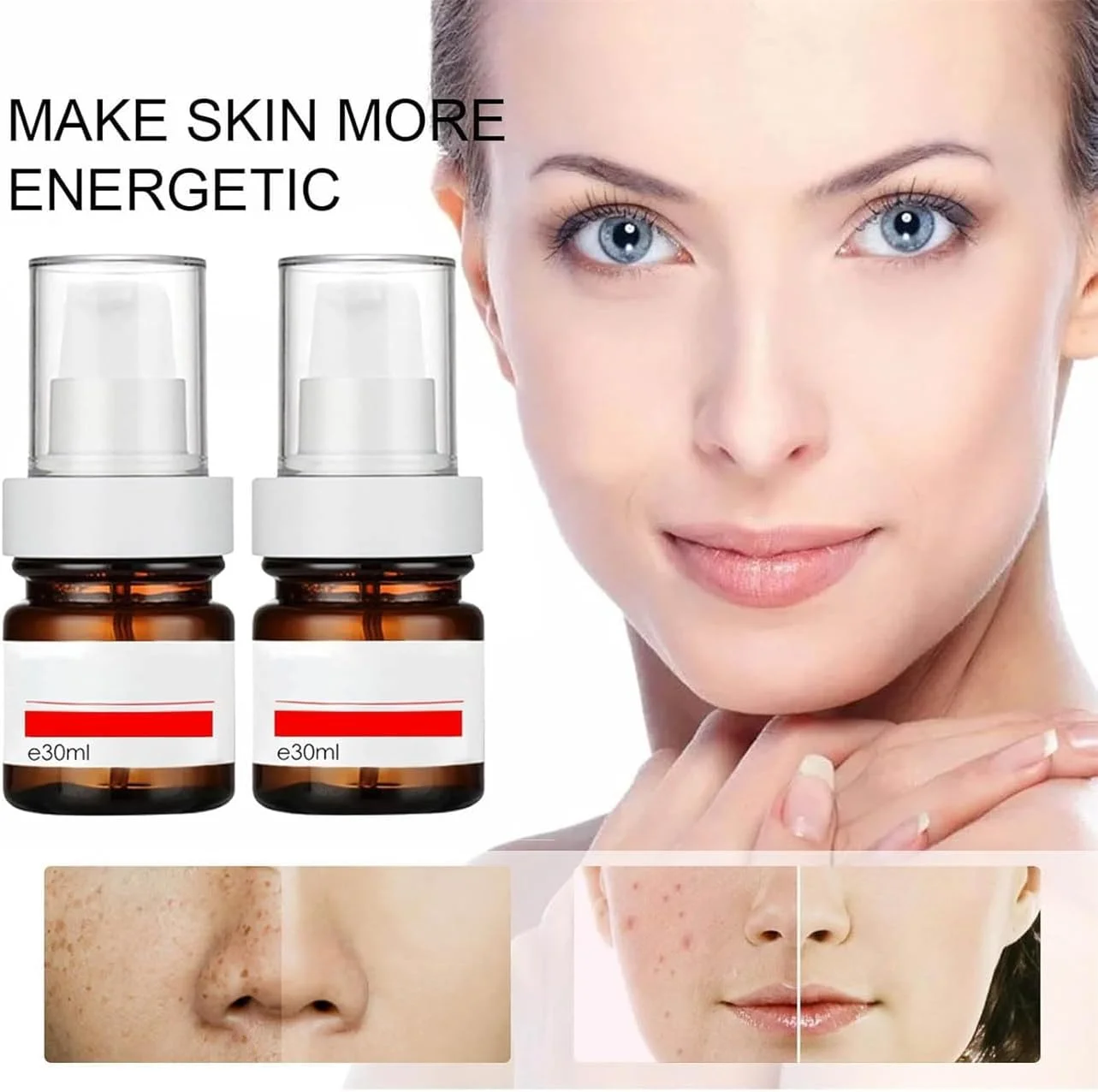 سرم ضد لک - اسانس از بین برنده کک و مک، سرم از بین برنده لک برای صورت، اصلاح کننده لک تیره برای صورت و بدن، اصلاح کننده لک برای انواع پوست، کرم کک و مک ویتامین C (1 عدد)