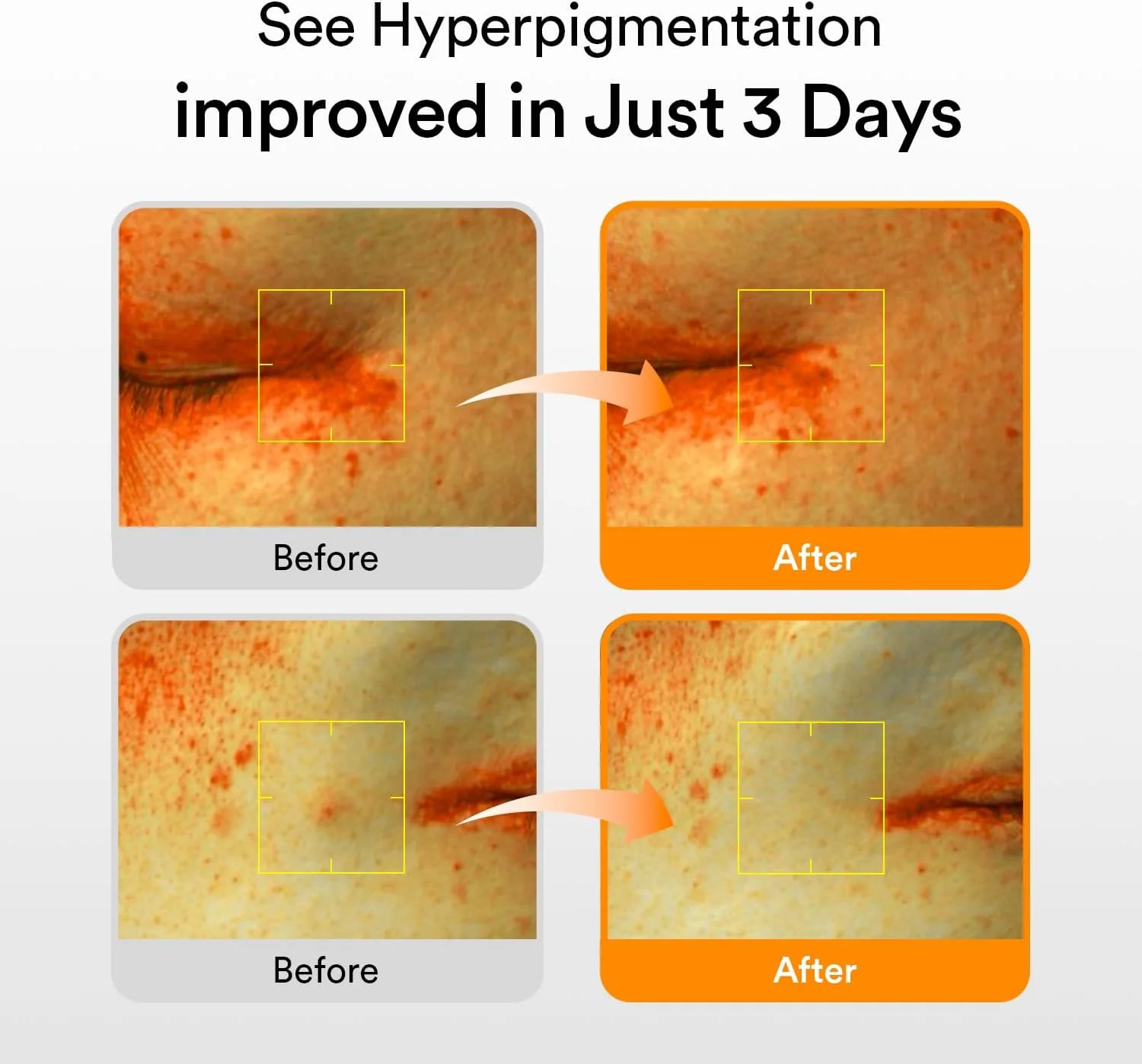 سرم روشن کننده پوست ابیب حاوی گلوتاتیون و ویتامین، 50 میلی لیتر | مراقبت پوست کره ای، درمان لک های تیره و هایپرپیگمنتیشن | سرم روشن کننده برای پوست های حساس و ناهموار | نیاسینامید، ویتامین C