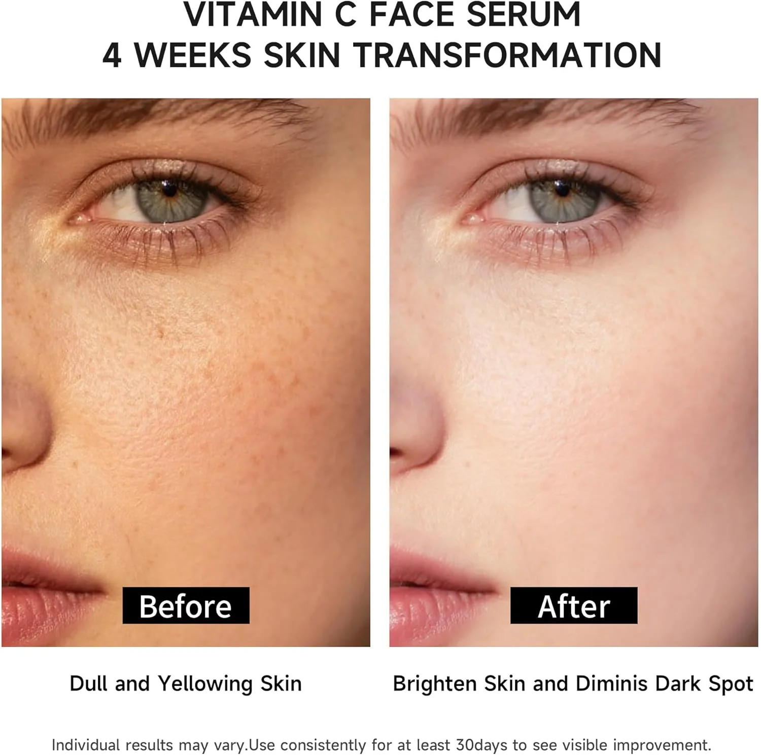 سرم ویتامین C صورت با هیالورونیک اسید، گلوتاتیون و آلوئه ورا ارگانیک، سرم آبرسان و روشن کننده، از بین برنده لک های تیره، سرم صورت ضد پیری، 30 آمپول