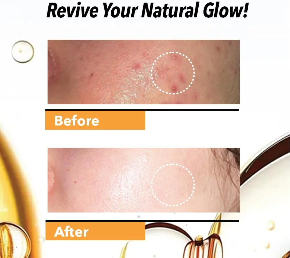 سرم صورت ویتامین C دکتر راشل برای روشن کنندگی و ضد پیری (مردان و زنان) (50 میلی لیتر، بسته 1 عددی)