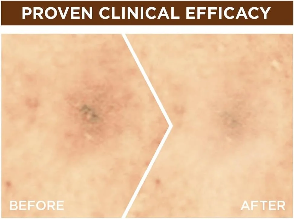 سرم تقویت کننده شبانه پوست صورت Garnier Skin Active Fast Bright با 10% ویتامین C خالص، 30 میلی لیتر