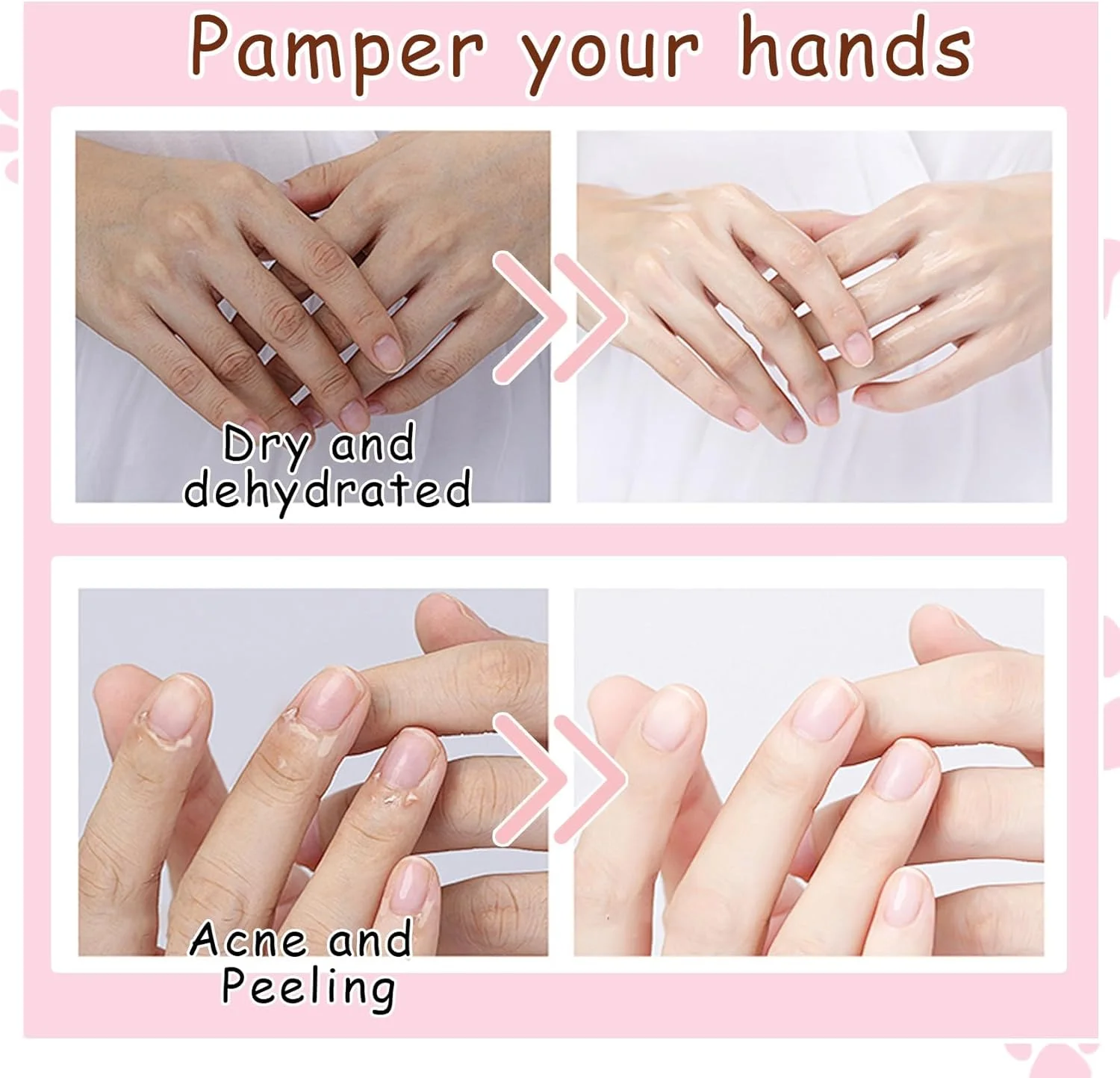 ماسک دست 6 عددی، 6 جفت ماسک لایه بردار و آبرسان دست برای دست های خشک، زبر و ترک خورده، دستکش های مرطوب کننده ملایم و ماندگار برای لمس نرم و لطیف