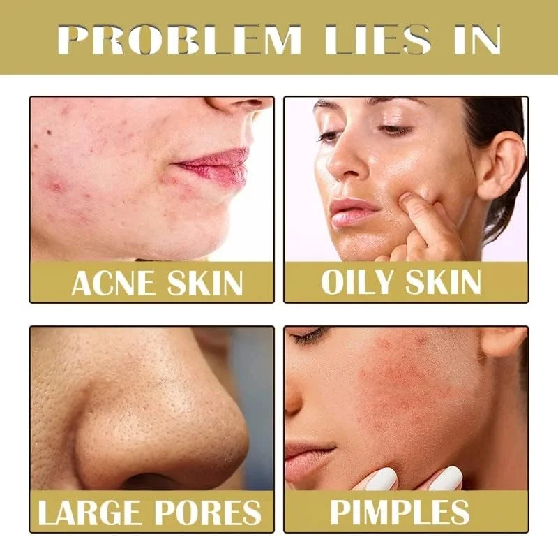 ماسک طلای پپتید سم مار رتینول گروسپه، ضد پیری، شفاف کننده و مرطوب کننده، بهبود پوست زبر، ماسک لایه بردار، سفت کننده، مرطوب کننده، تقویت کننده و مغذی پوست (3 عدد)