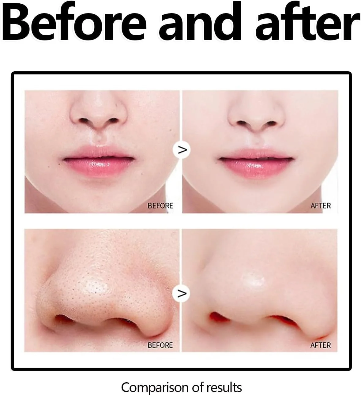 ماسک حذف جوش سرسیاه TERRIFI، ماسک صورت زغالی برای پاکسازی عمیق، حذف جوش های سرسیاه، منافذ و آکنه، مناسب برای صورت و بینی، ایده آل برای مراقبت از پوست زنان و مردان