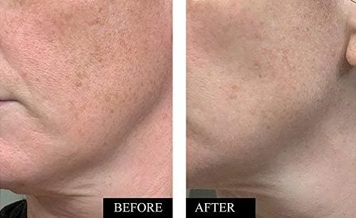 سرم ویتامین C ارگانیک برای صورت با اسید هیالورونیک - بهترین سرم صورت ضد چروک برای کاهش چین و چروک، لکه های تیره و آسیب های ناشی از آفتاب - سرم صورت روشن کننده و ضد پیری ویتامین C برای زنان و مردان - 50 میلی لیتر