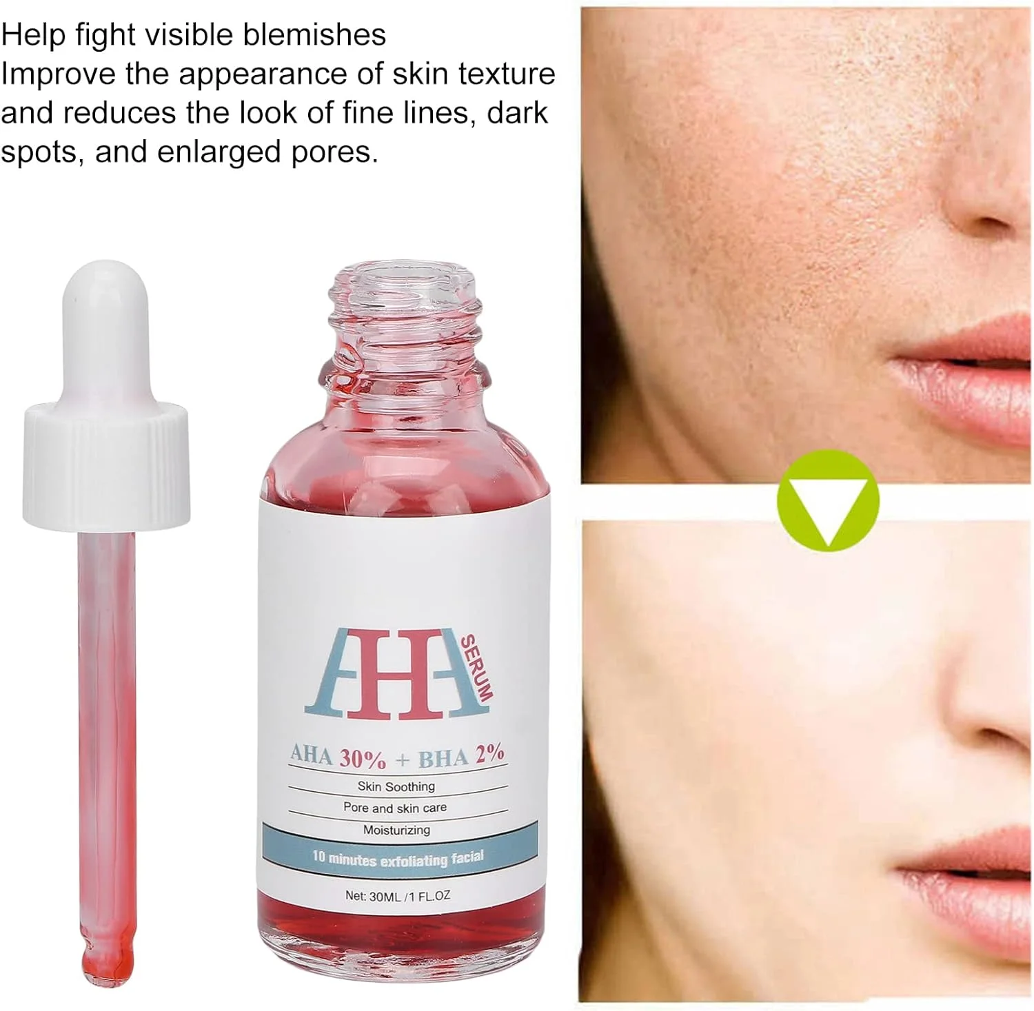 محلول لایه بردار 30 میلی لیتر AHA 30% + BHA 2%، سرم لایه بردار مرطوب کننده 30 میلی لیتر، لایه بردار صورت برای یکدست کردن رنگ پوست محلول لایه بردار 30 میلی لیتر AHA 30% + BHA 2%، سرم لایه بردار مرطوب کننده 30 میلی لیتر، لایه بردار صورت برای یکدست کردن رنگ پوست