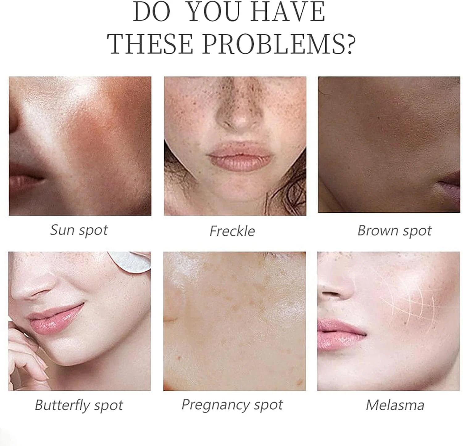 سرم اسید سالیسیلیک، سرم صورت AHA 30%+BHA 2%، محلول لایه بردار، سرم صورت لایه بردار، سرم روشن کننده و اصلاح کننده لک های تیره، روغن صورت لایه بردار BHA برای لایه برداری، مرطوب سازی و تسکین صورت