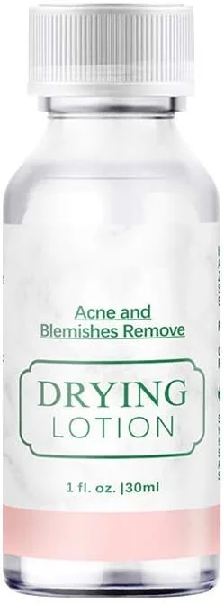 سرم صورت برای آکنه، لوسیون مات کننده مراقبت از پوست 30 میلی لیتر، سرم صورت برای رفع لک های آکنه، سرم روشن کننده و لایه بردار پوست صورت برای جای زخم های آکنه، محو کننده حلقه های تیره، ضد التهاب و ضد آکنه