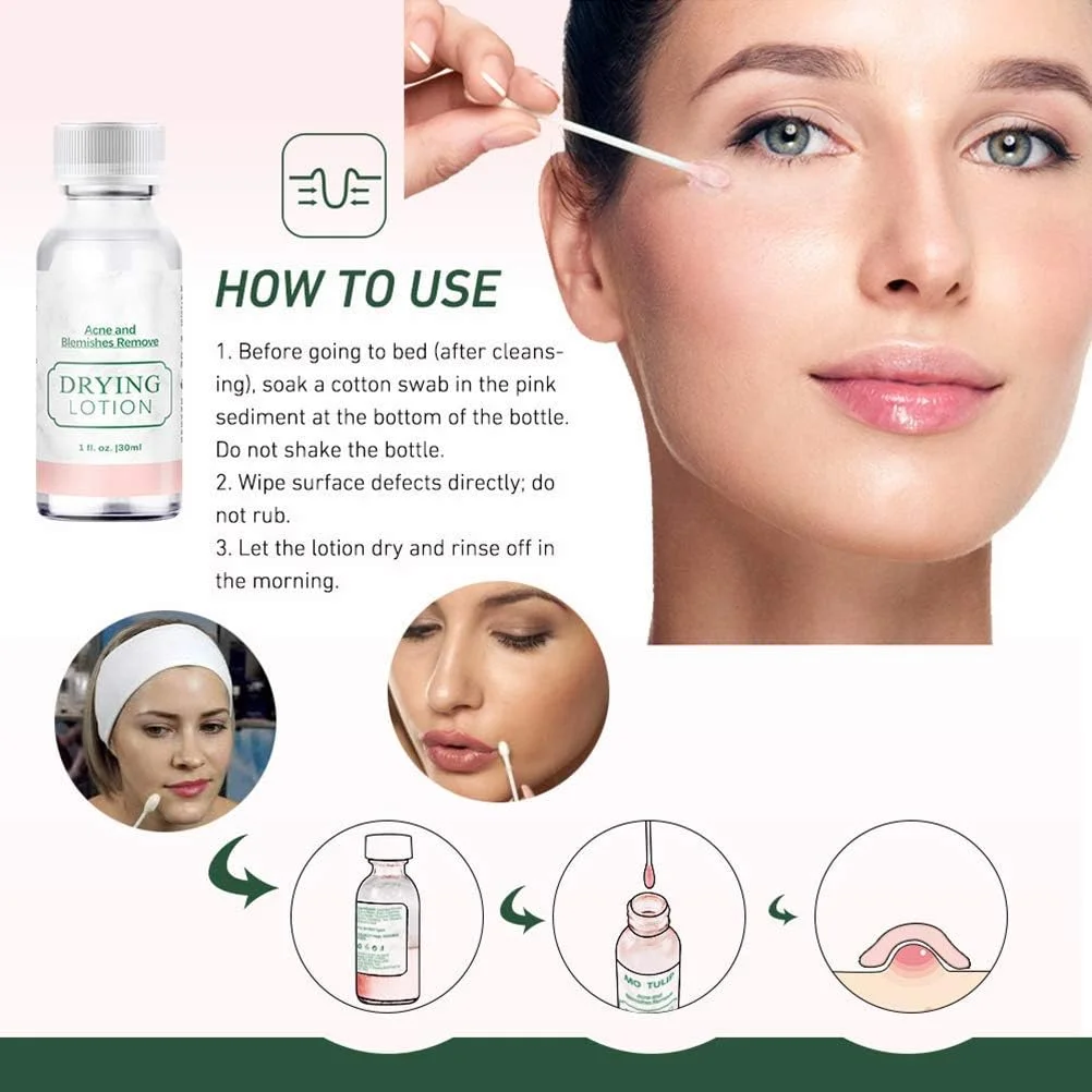 سرم صورت برای آکنه، لوسیون مات کننده مراقبت از پوست 30 میلی لیتر، سرم صورت برای رفع لک های آکنه، سرم روشن کننده و لایه بردار پوست صورت برای جای زخم های آکنه، محو کننده حلقه های تیره، ضد التهاب و ضد آکنه