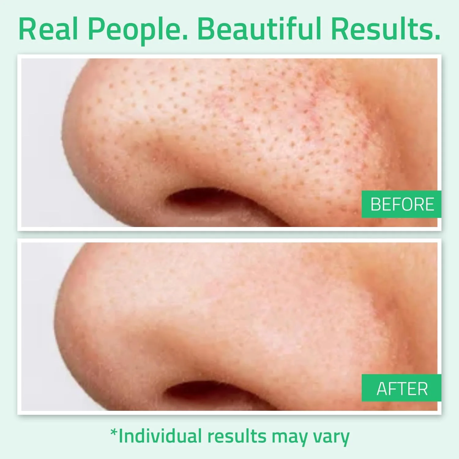 تونر گلیکولیک اسید YEOUTH برای صورت با فندق افسونگر، تونر صورت، لایه بردار ملایم آبرسان بدن و صورت برای زنان، تونر پوست، تونر گلیکولیک 8%، 177 میلی لیتر