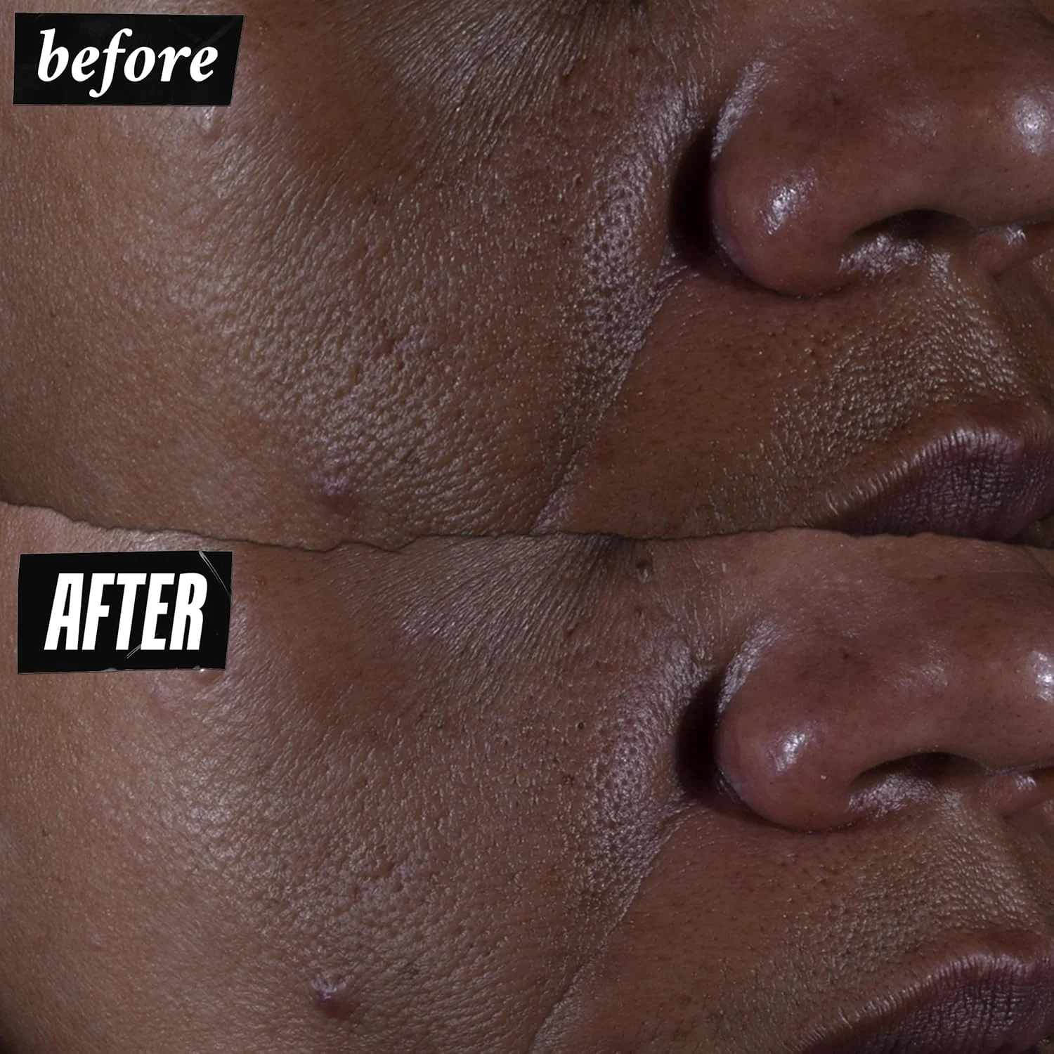 سرم اسید گلیکولیک ۹.۸% خالص و قوی Kiehl's، سرم صورت غلیظ برای لایه برداری و درخشش پوست، بافت پوست را به وضوح صاف می کند و درخشش پوست را افزایش می دهد، مناسب برای انواع پوست، بدون عطر - ۳۰ میلی لیتر